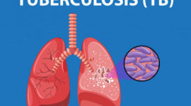 Surabaya Temukan Ribuan Kasus TBC, Pengobatan Pasien Capai 84 Persen. (Foto: Ilustrasi/Ist)